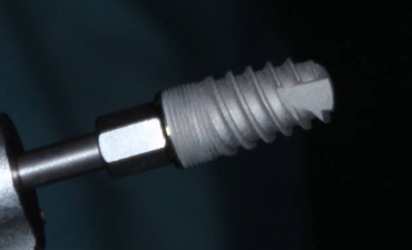 Implantes_4